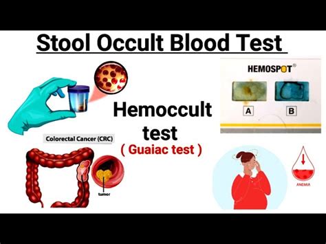 Fecal Occult Blood Test Rapid Test