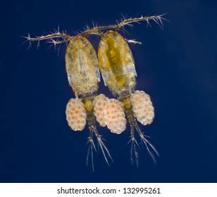 Cyclops Copepod Copepods Dorsal Ventral Eggs Stock Photo 132995261 ...