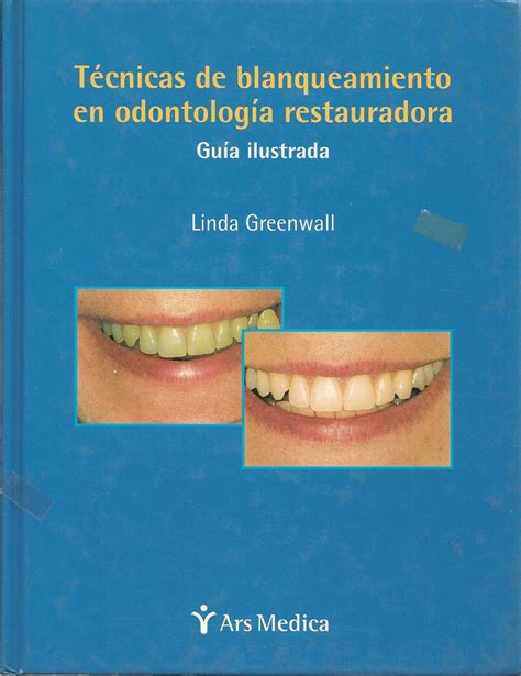 Técnicas de blanqueamiento en odontología restauradora Ediciones