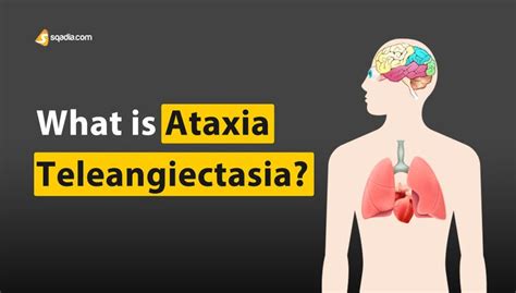 What is Ataxia Telangiectasia|Louis Barr Syndrome Immunology | sqadia.com