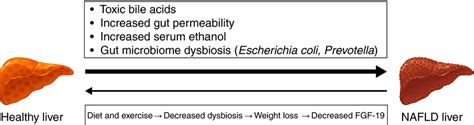 Association Between Gut Microbiome And NAFLD Patients With NAFL Can