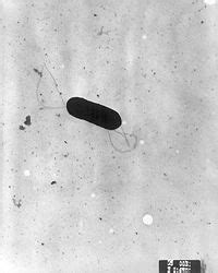 Listeria Monocytogenes Encyclopedia Article Citizendium