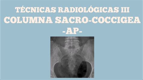 Proyección Ap De Columna Sacro Coccigea Youtube