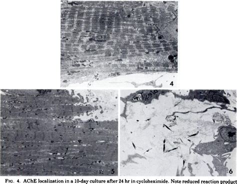 Figure From Ultrastructural Localization Of Acetylcholinesterase In