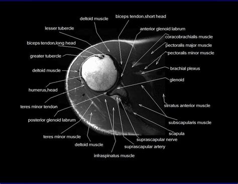 Shoulder Anatomy Mri Shoulder Axial Anatomy Free Cross Sectional Anatomy