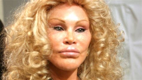 Jocelyn Catwoman Wildenstein Bekend Van Vele Chirurgische Ingrepen