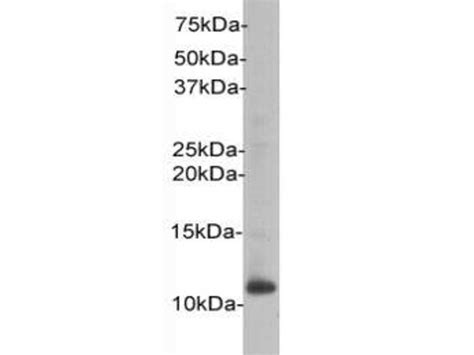 Beta 2 Microglobulin Polyclonal Antibody 0808 2