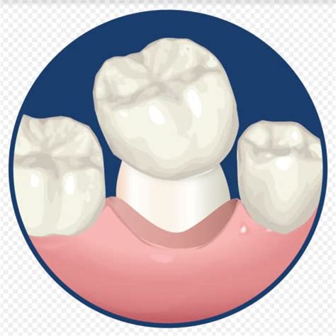 Dentemp Maximum Strength Loose Cap And Lost Filling Repair Dental