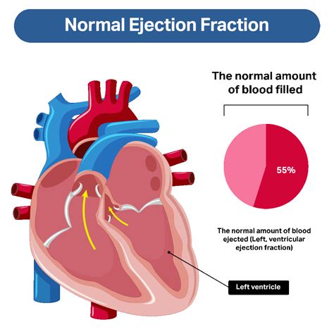 Ejection Fraction Range For Heart Failure At Stephen Galasso Blog