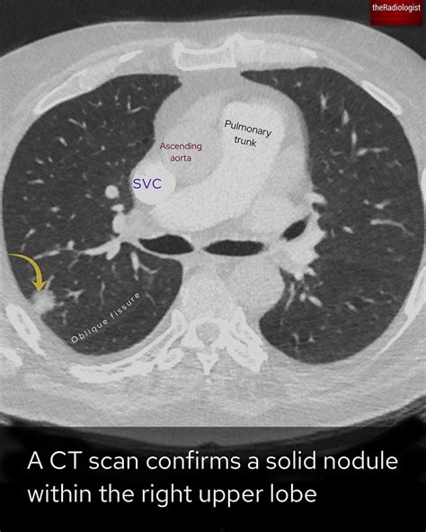 TheRadiologist On Twitter Explanation 3 3