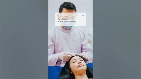 akupunktur wajah youtube