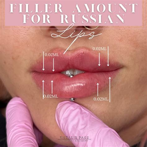 Lip Filler Journey Artofit