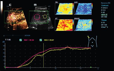 Current Aspects Of Multimodal Ultrasound Liver Diagnostics Using