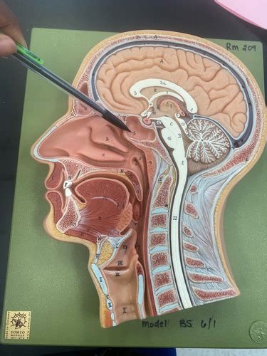 Sagittal Head Flashcards Quizlet