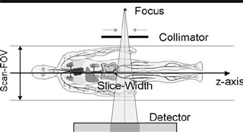 Beam Collimation Ct Scan The Best Picture Of Beam