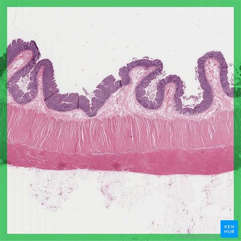 C Lon Anatomia Histologia Fun O E Composi O Kenhub