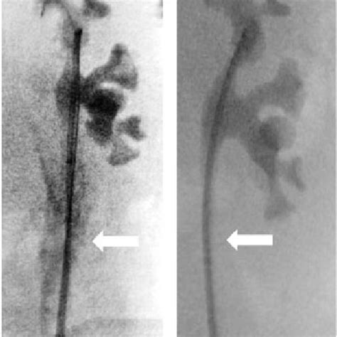 Representative Selection Of Intraoperative Fluoroscopic Images Showing