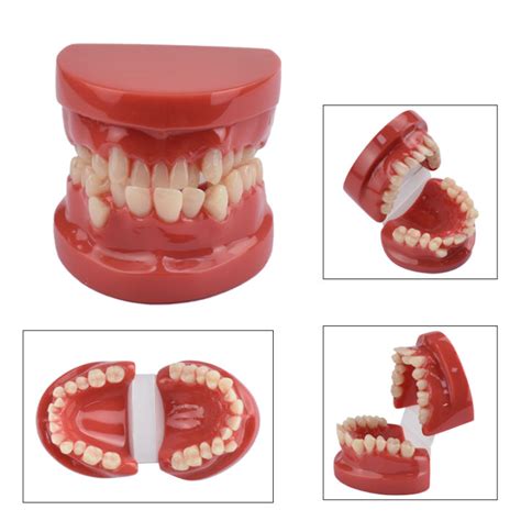 Dental Teaching Model Teeth Malocclusion Model For Dental Student