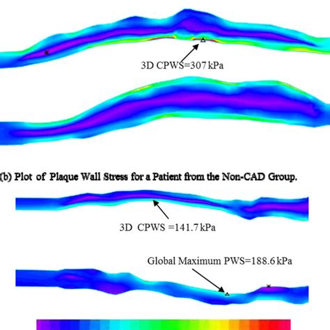 Overview Of 3D FSI Solution Behaviours Based On MR Images Of The Plaque