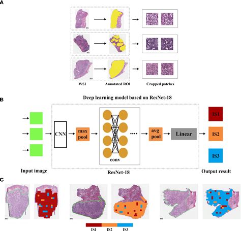 Frontiers The Immune Subtypes And Landscape Of Gastric Cancer And To