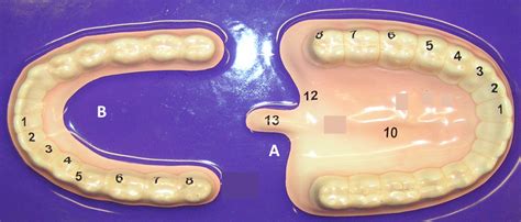 Adult Teeth Diagram Quizlet