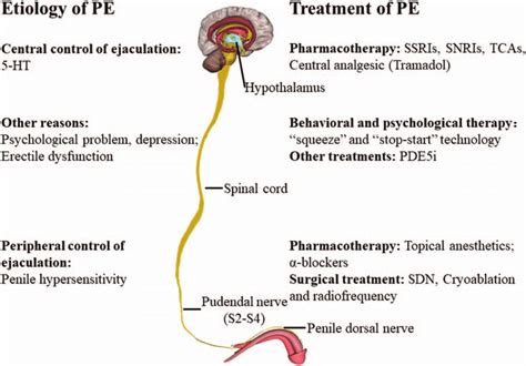 The Etiology And Treatment Of Pe 5 Ht 5 Hydroxytryptamine Pde5i