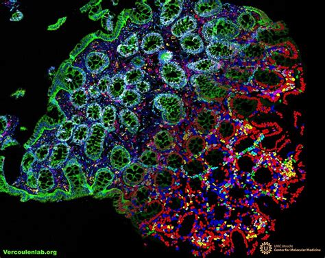 Matisse Method Single Cell Spatial Analysis Out Now Vercoulen Lab