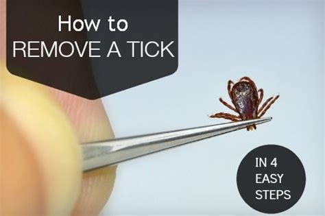 How To Remove A Tick In 4 Easy Steps Mydr Au First Aid