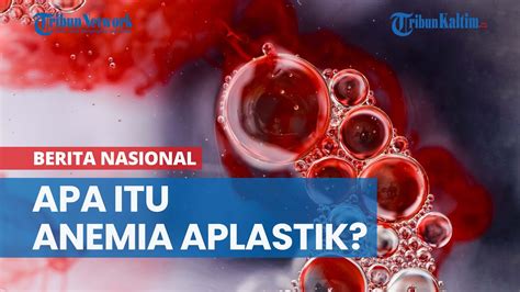 Apa Itu Anemia Aplastik Penyakit Yang Diderita Babe Cabita Youtube