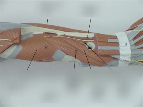 Deep Muscles (Dorsal-Deep) Diagram | Quizlet