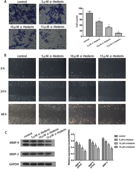 Hederin Increases The Apoptosis Of Cisplatin Resistant Gastric Ott