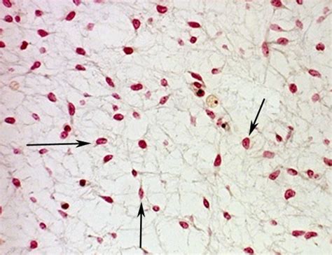 HISTOLOGY CONNECTIVE TISSUE Flashcards Quizlet