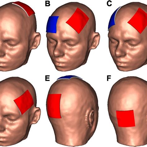 The Six Standard TDCS Configurations Simulated In This Study Targeting