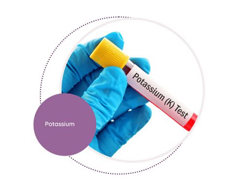 Potassium Mediscan Lab