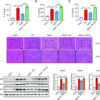 NaHS Alleviates Hepatic Injury And Inflammatory Response In The