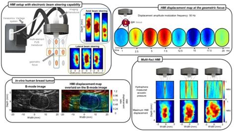 An Efficient And Multi Focal Focused Ultrasound Technique For Harmonic