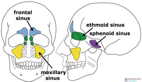 CT PARANASAL SINUS (PNS) WITH CONTRAST - AskRadiographerDotCom