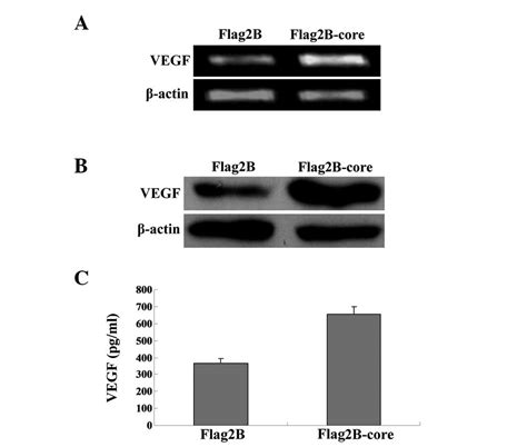 Hepatitis C Virus Core Protein Induces Hypoxia‑inducible Factor 1α