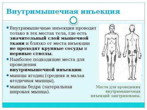 Внутримышечная инъекция: алгоритм введения, какие осложнения