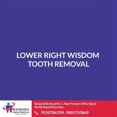 Wisdom Teeth Extraction Rdmolar Drteethacademy Fptbongda