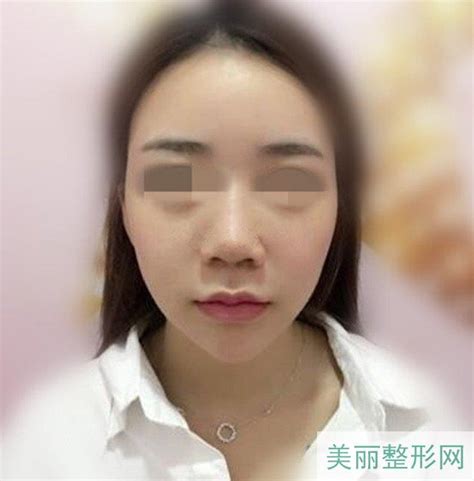 沈阳医大二院美容科哪个大夫好？技术and案例解析，附专家收费标准美嘉整形网