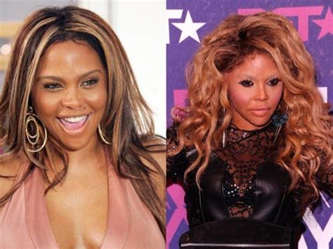 Worst Cases Of Celebrity Plastic Surgery Gone Wrong