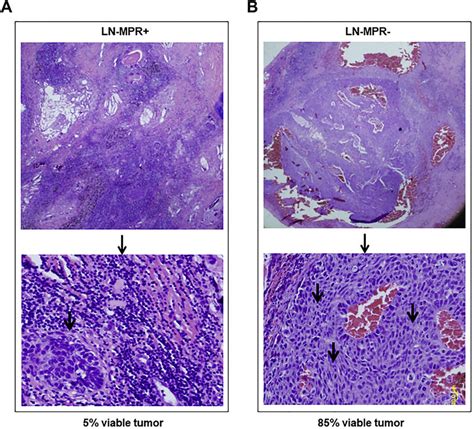 Representative Examples Of The Histopathologic Features Of Lymph Nodes