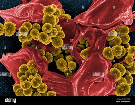 Coloured Scanning Electron Micrograph Sem Of Methicillin Resistant