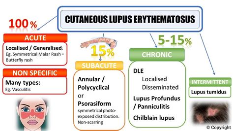 The Four Types Of Lupus