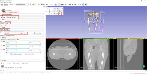 3D Slicer Volume Rendering模块使用简单说明 CSDN博客