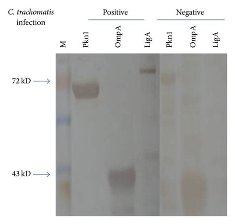 Western Blot Using Pooled Sera From Chlamydia Infected Samples Of Human