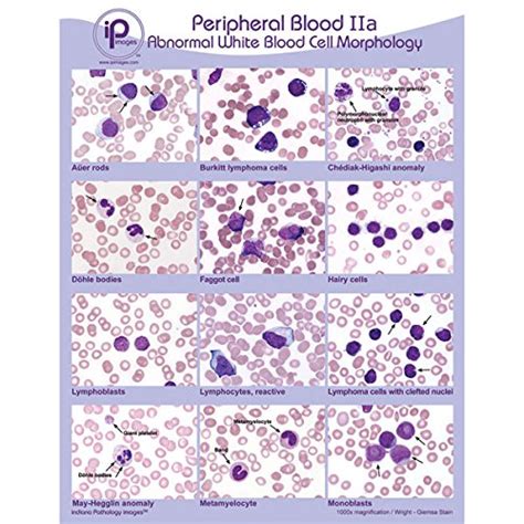 Buy Peripheral Blood Abnormal WBC Morphology Online At DesertcartUAE