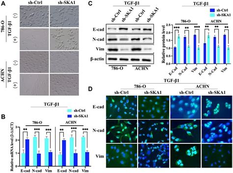 Ska1 Silencing Blocks Tgf β1 Induced Emt In Ccrcc Cells A