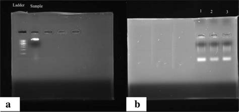 A Isolated Dna In 1 Agarose Gel B Amplified 16s Rrna Fragment Of